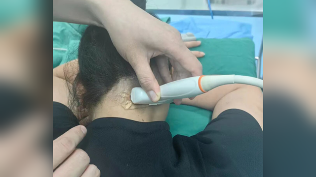 鄭州大學附屬腦病醫院（駐馬店市第二人民醫院）：為破十年偏頭痛，她從廣州來到駐馬店